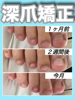 ネイル nail salon petillantのネイルデザイン
