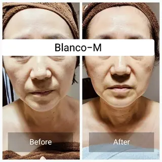 Blanco-M mayaのエステ・リラクイメージ