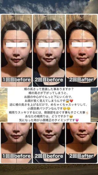 💎後悔させない小顔 矯正💎イトヤマ🌱のエステ・リラクイメージ