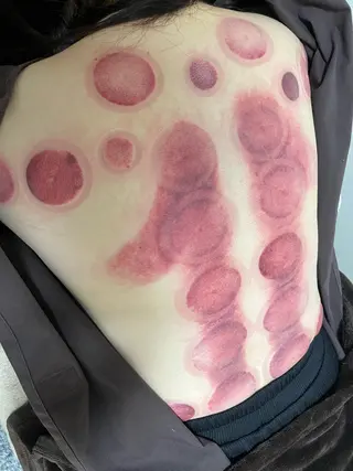 やはた 鍼灸整骨院のエステ・リラクイメージ