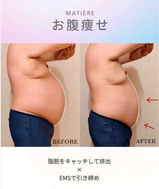 痩身×巡り改善 🌿MATIÈREのエステ・リラクイメージ