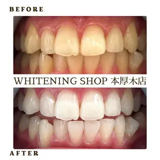 メンズ ホワイトニング ショップ本厚木のその他イメージ