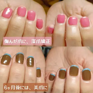 ネイル 深爪矯正/爪育成ケア manie nailのネイルデザイン