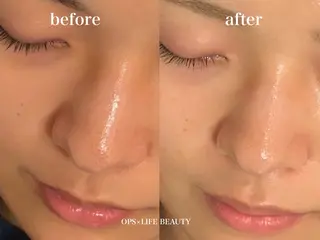 OPS×LIFE BEAUTY/maiのエステ・リラクイメージ