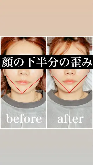 🌈歪み専門🌈 バリンタイ すぎうらのエステ・リラクイメージ