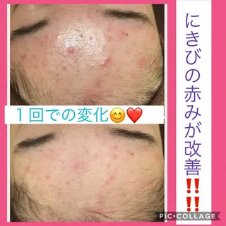 ミディアム カラー パーマ ヘアアレンジ メンズ キッズ ネイル マツエク・マツパ ニキビ・肌質改善専門 ♡人生が変わるサロンのエステ・リラクイメージ