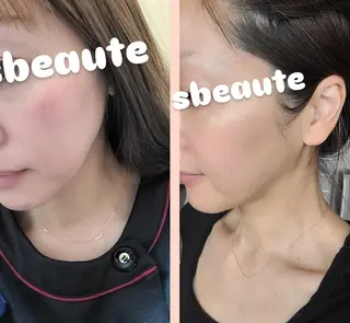 sbeaute  エスボーテのエステ・リラクイメージ