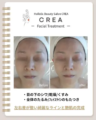 ☾⭒肌質改善|脳首肩 疲労解消CREA⭒☽のエステ・リラクイメージ