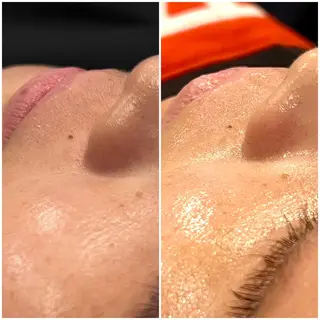 VIO脱毛＆SPA ルミナステラのエステ・リラクイメージ