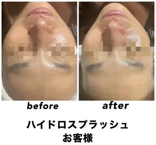 ネイル・エステサロン UILANIのエステ・リラクイメージ