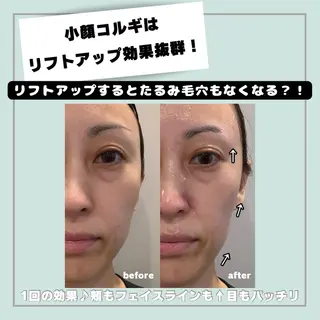 韓国肌管理HARRY ・ハリー🤍大村のエステ・リラクイメージ