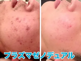 エステサロン RIDのエステ・リラクイメージ