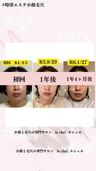 小顔・毛穴専門 ルシェルのエステ・リラクイメージ