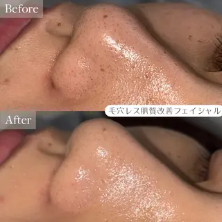 LUCOL￤池袋西口 ￤肌質改善￤EMIのエステ・リラクイメージ