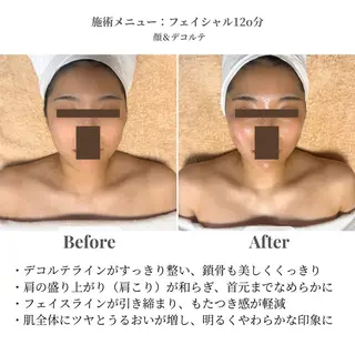 【新大阪】痩身/小顔 美肌フェイシャルのエステ・リラクイメージ