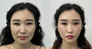 ネイル 愛維美水光専門店 川崎彩鳳のエステ・リラクイメージ