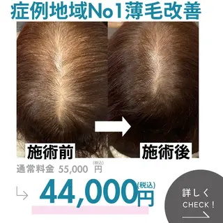 最速 毛穴シミ改善 いくえのその他イメージ