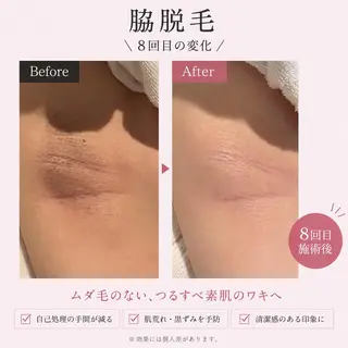 【美肌・脱毛専門店】 SARA 恵比寿店のエステ・リラクイメージ