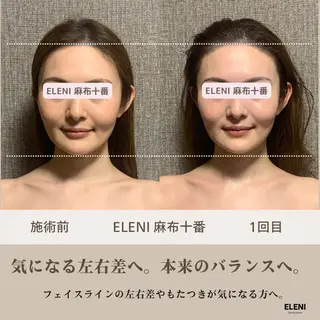 麻布十番小顔コルギ 姿勢矯正リアン💗のエステ・リラクイメージ