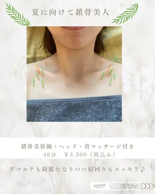 肌質改善美容鍼 ×ハーブピーリングのエステ・リラクイメージ