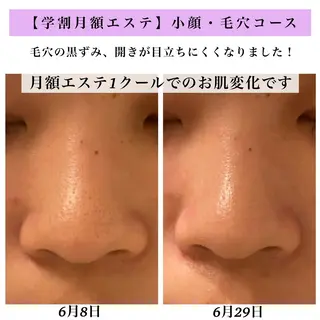 Bellesthe (ベルエステ)のエステ・リラクイメージ