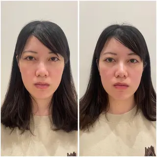 🌸美容鍼サロン🌸 メゾンブランシェ🌈のエステ・リラクイメージ