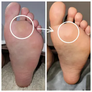 ネイル&巻き爪サロン AKnailのネイルデザイン