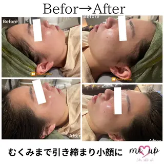 Meupニキビ専門店 背中/ハーブ/肌管理のその他イメージ