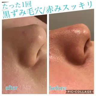 ロング カラー パーマ ヘアアレンジ キッズ ネイル マツエク・マツパ EnsorClair 代表 野口真央のエステ・リラクイメージ