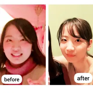 小顔&たるみアップ 専門店リラーシェのエステ・リラクイメージ