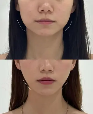 ネイル 愛維美水光専門店 川崎彩鳳のエステ・リラクイメージ