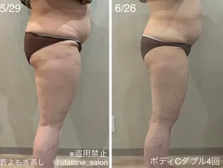 若よもぎ蒸し/脳洗浄 艶肌wax脱毛のエステ・リラクイメージ