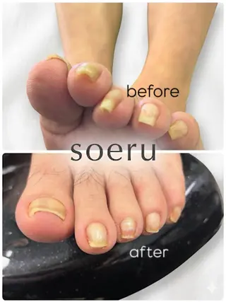 soeru フットケア専門店のその他イメージ