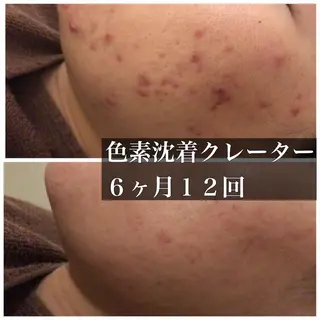 ミディアム カラー パーマ ヘアアレンジ メンズ キッズ ネイル マツエク・マツパ ニキビ・肌質改善専門 ♡人生が変わるサロンのエステ・リラクイメージ
