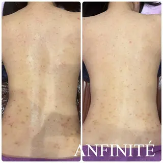 ANFINITÉ アンフィニテのエステ・リラクイメージ
