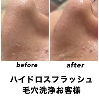 ネイル・エステサロン UILANIのエステ・リラクイメージ