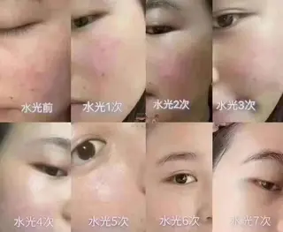 マツエク・マツパ 愛維美水光専門店 川崎彩鳳のエステ・リラクイメージ