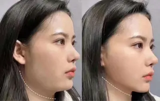 愛維美水光専門店 川崎彩鳳のエステ・リラクイメージ