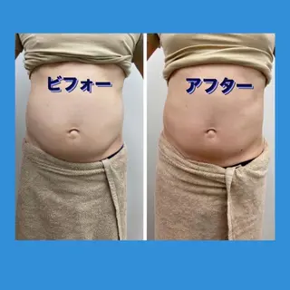 ショールームエステ becoのエステ・リラクイメージ