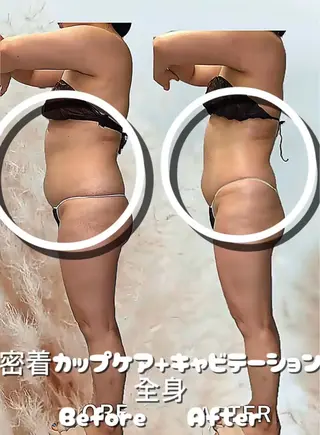 痩身・脱毛・肌管理 Rechica心斎橋のエステ・リラクイメージ