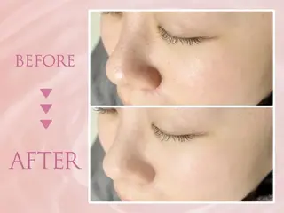 clear lab ♡marina♡のエステ・リラクイメージ