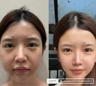 マツエク・マツパ 愛維美水光美肌専門店 メンズレディースokのエステ・リラクイメージ