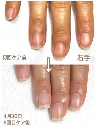 ネイル 自爪育成ネイルサロン Pause(ポーズ)のネイルデザイン