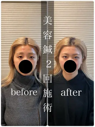 鍼灸 Refineのその他イメージ