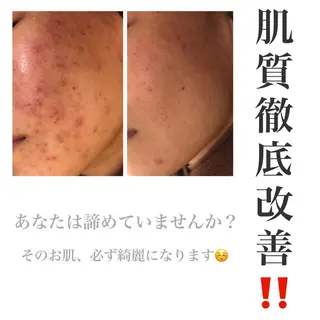 ミディアム カラー パーマ ヘアアレンジ メンズ キッズ ネイル マツエク・マツパ ニキビ・肌質改善専門 ♡人生が変わるサロンのエステ・リラクイメージ