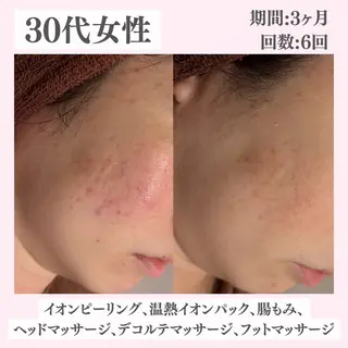 ニキビ・肌質改善専門 ♡人生が変わるサロンのエステ・リラクイメージ