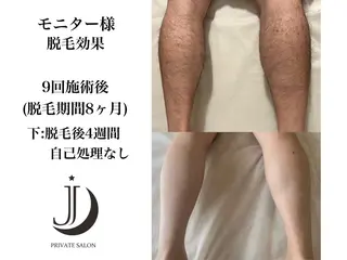 private salon Jのエステ・リラクイメージ