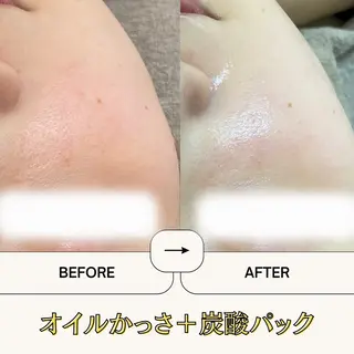 《美肌・小顔》美容鍼 &マッサージ*MEIのエステ・リラクイメージ