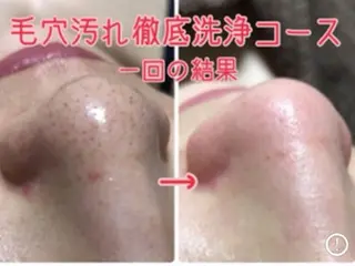 トータルビューティー サロンワンダーのネイルデザイン
