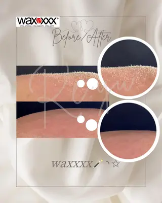 Re:yu┃wax 脱毛┃糸島市のエステ・リラクイメージ